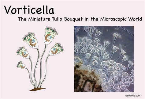  Vorticella! Een Microscopische Dierenwereld met Fluisterende Tentakels en Een Vorticiteit van Bewegingen